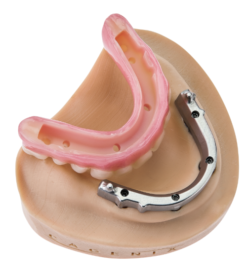 Cagenix Dental AccuFrame 360 product sitting on base